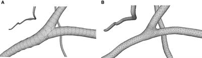 Robust quasi-uniform surface meshing of neuronal morphology using line skeleton-based progressive convolution approximation